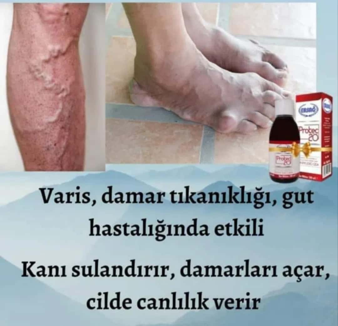 Qida əlavəsi Ersağ Protec 20 - Tenderyard