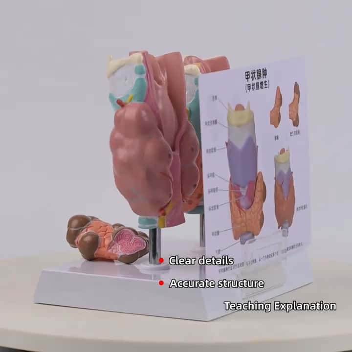Thyroid gland pathology model - Tenderyard
