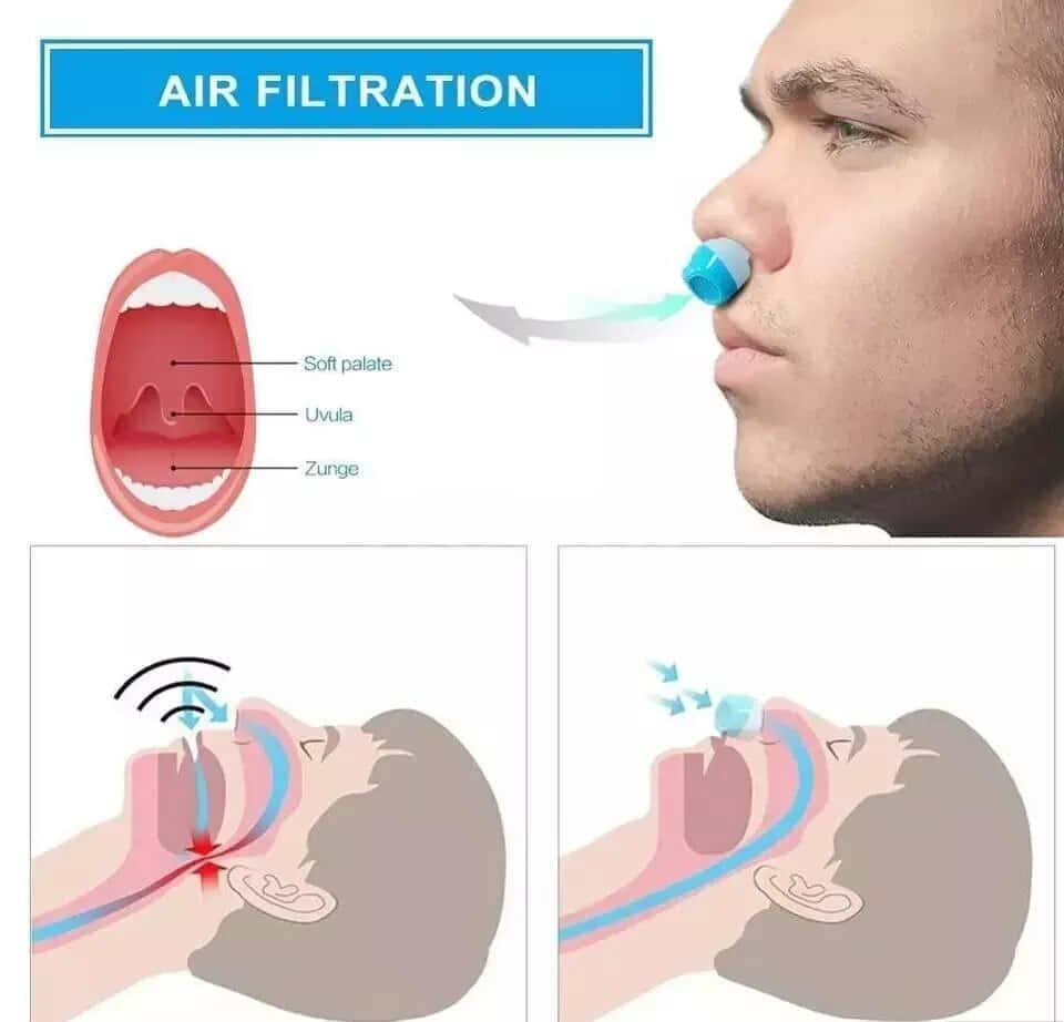 BestBrands Anti-Snoring Nasal Breathing Device - Tenderyard