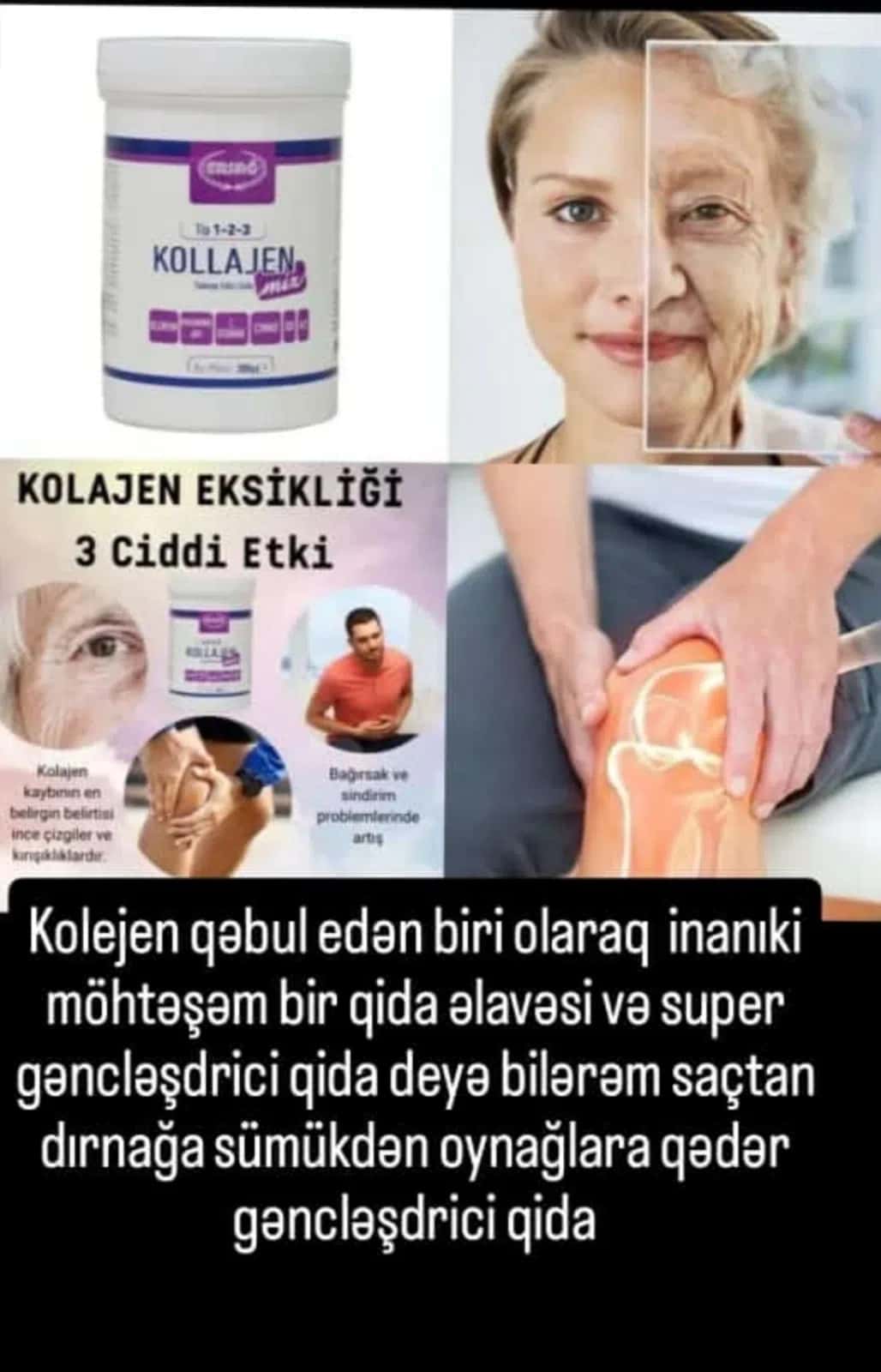 Kollajen qida əlavəsi Tip 1-2-3 Kollajen Mix - Tenderyard