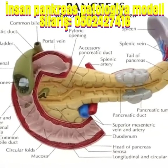 Human pancreatic pathology model - Tenderyard
