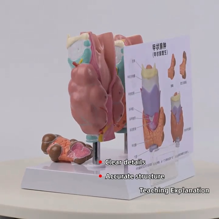 Thyroid gland pathology model - Tenderyard