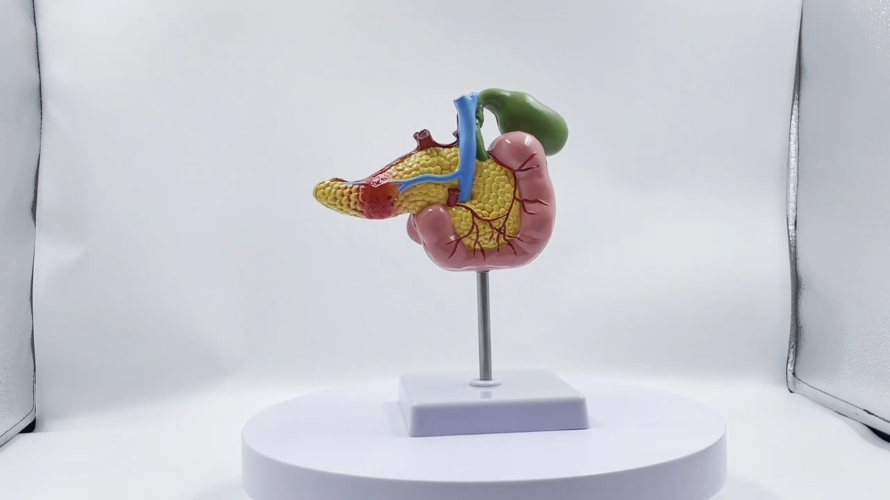 Gallbladder pathology model - Tenderyard