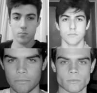 Jawline Çənə Masajı və Əzələ Trenajoru — şəkil 7
