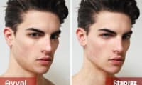 Jawline çənə və üz əzələləri üçün espander — şəkil 9