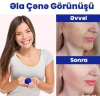 Jawline çənə və üz əzələləri üçün espander — şəkil 5