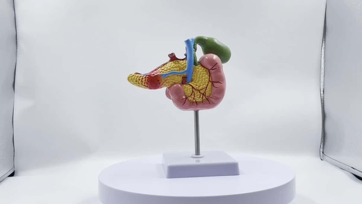 Gallbladder pathology model - Tenderyard