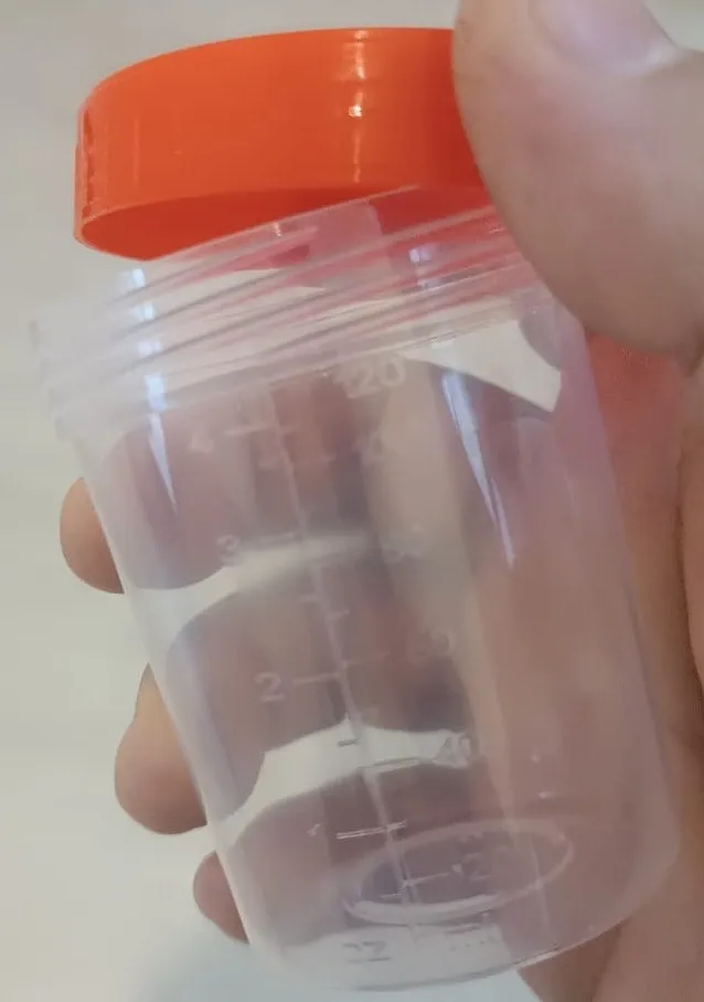 Plastik analiz qabları — şəkil 6