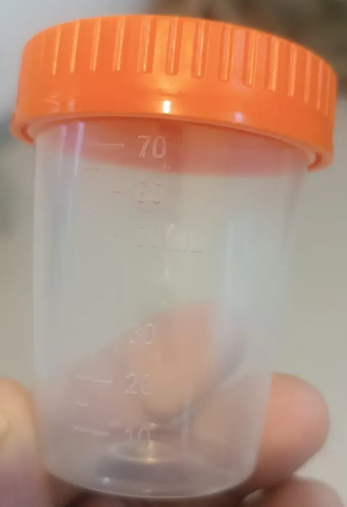 Plastik analiz qabları — şəkil 4
