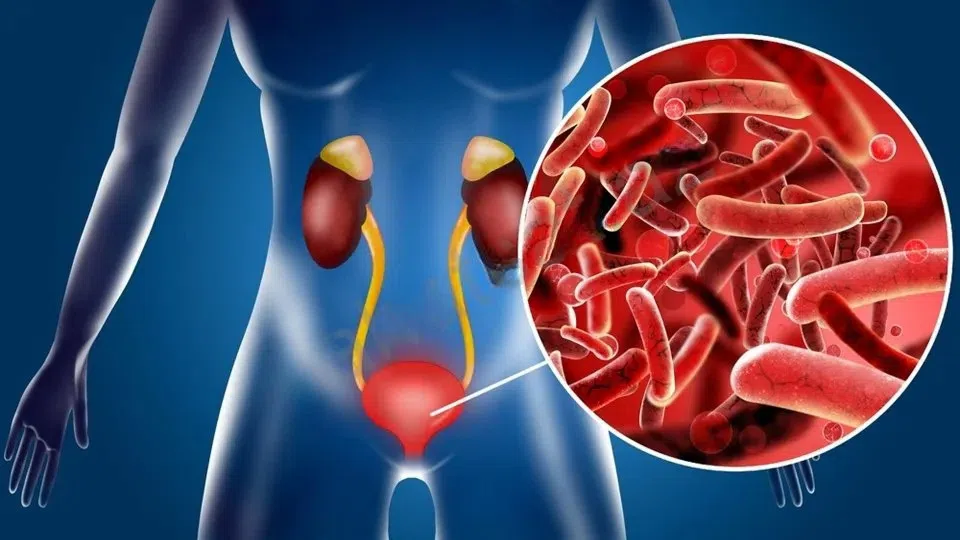 Recovery from cystitis with dietary supplements - Tenderyard