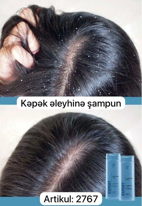 Faberlinə dəvət — şəkil 2