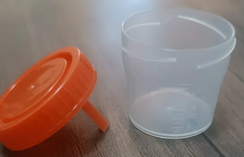 Plastik analiz qabları — şəkil 7