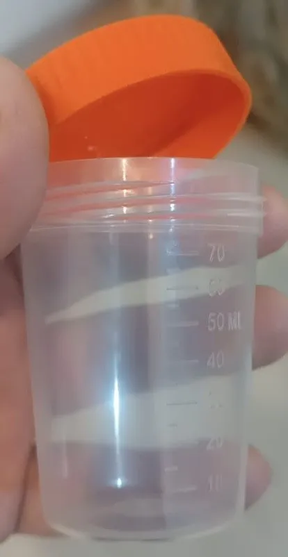 Plastik analiz qabları — şəkil 2