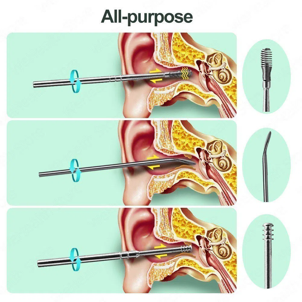 Ear wax removal tool | Qulaq kiri çıxaran alət — şəkil 4